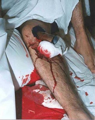 injury1.jpg