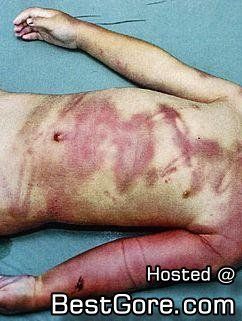 autopsy3.jpg