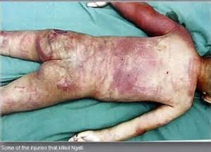 autopsy4.jpg