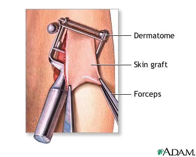 ProcDerm.jpg