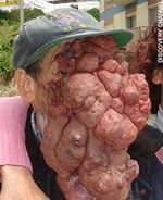 face-tumor-jose-mestre.jpg