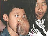 tumor-320-08.jpg
