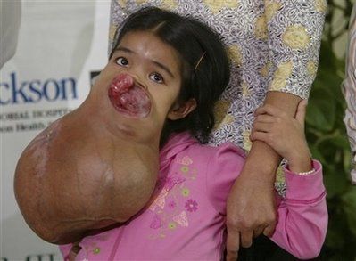tumor 1.jpg