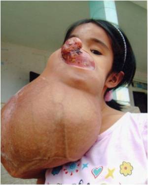 US-Vietnam-health-tumor-21112.jpg