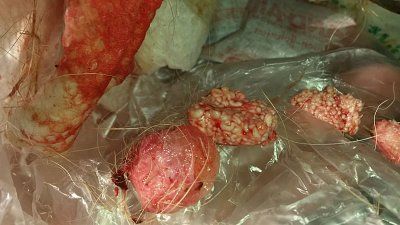 20151231_132504-resized.jpg