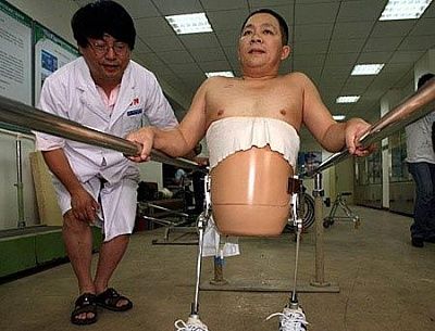 miracle-legs.jpg