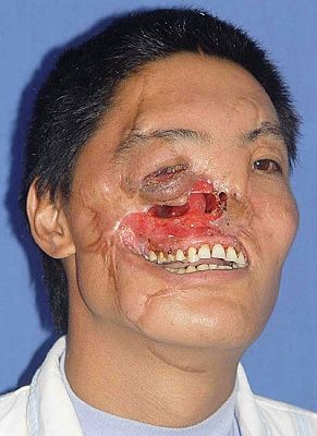 face-before_47790a.jpg