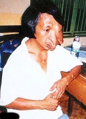 forpublication_agentorangevietnam.jpg