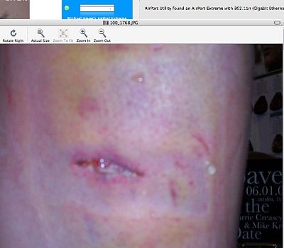 wound.jpg