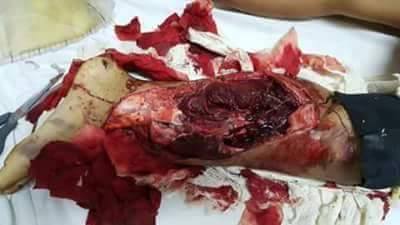 Name:  Smash6.jpg
Views: 1134
Size:  14.4 KB