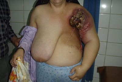 charonboat_dot_com_breast_cancer1.jpg