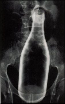 charonboat_dot_com_foreign_body_vagina.jpg