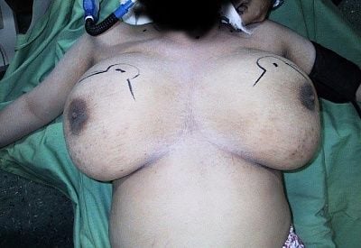 breasts1.jpg