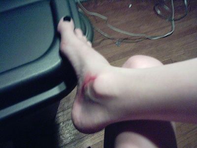 bloody2.jpg