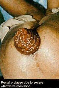 worm2.jpg