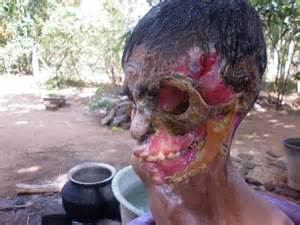Necrotitusfaciatus.jpg
