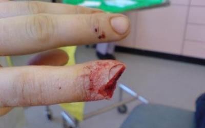 nasty_cut.jpg