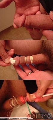 penis.1.jpg