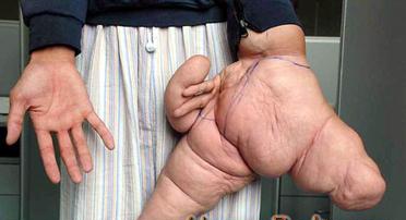 gigantic-hand.jpg