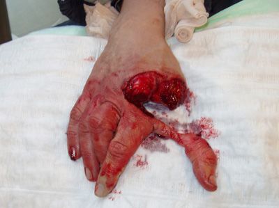 HAND%202.jpg