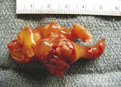 fetus-fetu.jpg