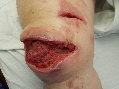 knee2.jpg