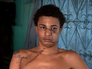 Name:  gabriel-facada-8ago18-3-367x275.jpg
Views: 722
Size:  10.0 KB