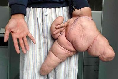 fingers.jpg