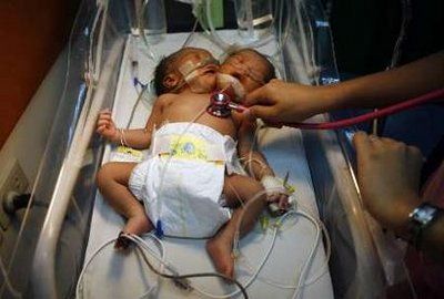 baby04.jpg