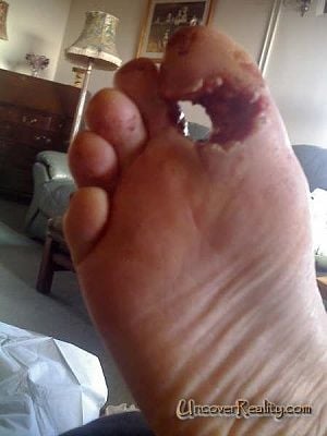 toe1.jpg
