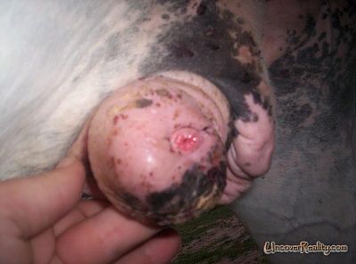 carcinoma-cancer-penis-other-side-2gus.jpg