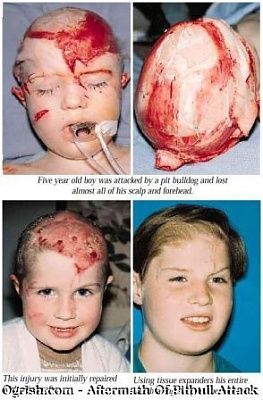 pit_bull_attack2.jpg
