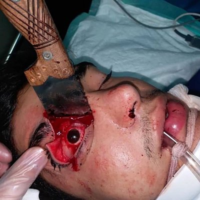 knife-20in-20eye-20-281-29.jpg
