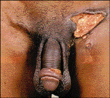 chlamydia2.gif
