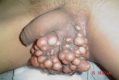 scrotum-fig1.jpg