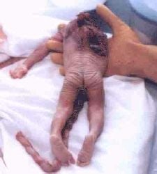 aborted-20baby.jpg