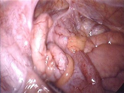 appendix1.jpg