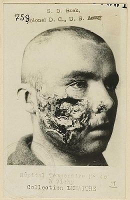 ww1-pic.jpg