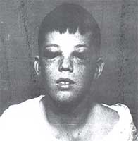 my_lobotomy-howard_after.jpg
