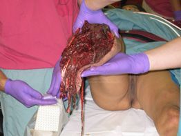 toe_popper_824_208md.jpg