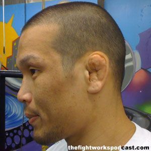 cauliflower-ear-baret.jpg