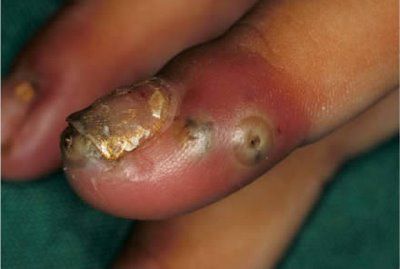 finger.jpg