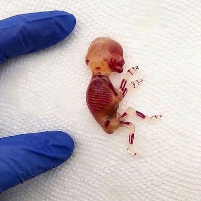 11-20week-20old-20human-20fetus.jpg