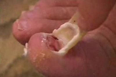toenail.jpg