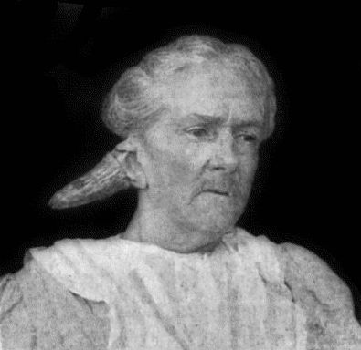 sebaceous-horn.jpg