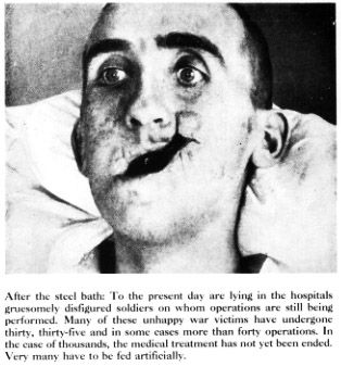 11608-horrible-facial-wartime-facial-woundsbig5.jpg