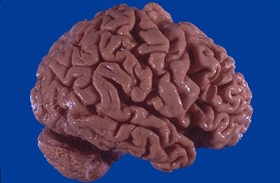 cns088.jpg