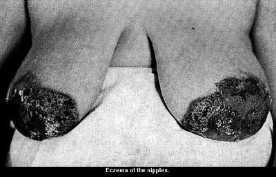 nipples.jpg