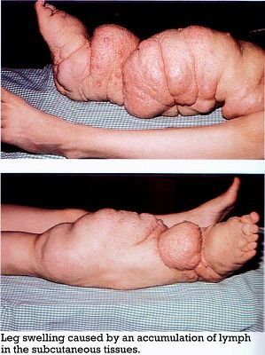legs124.jpg