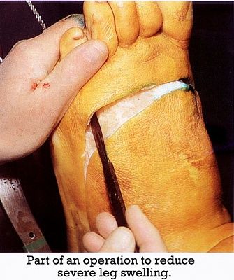 legs135.jpg